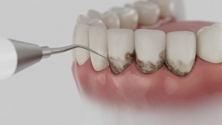 Trusted Emergency Dentist service in Wanatah, IN - Dentist Open Now